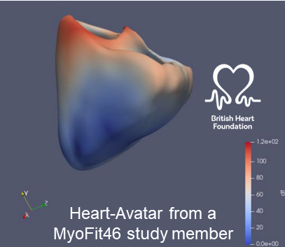 Heart